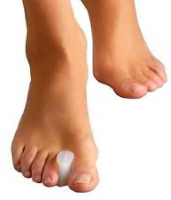 2 Pairs x Hallux Valgus Correction Toe Spacer