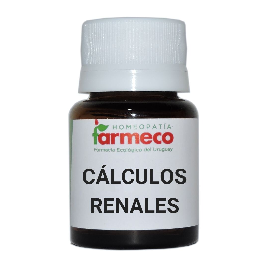 Cálculos Renales Glóbulos
