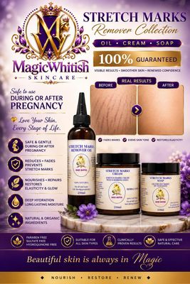 Stretch Marks &amp; Scars Remover/ Cream With seeds/Oil/Soap 100% Effective 