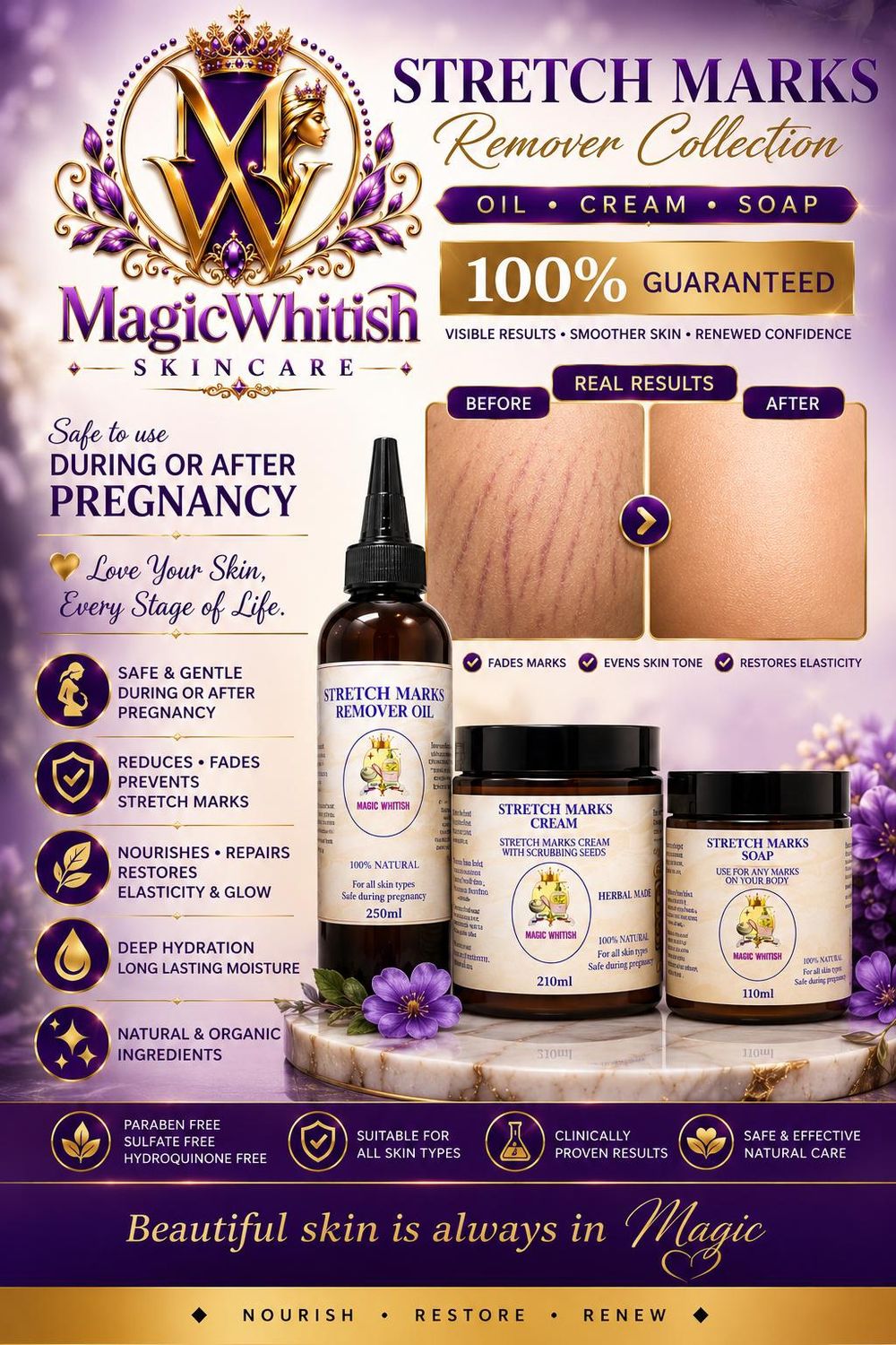 Stretch Marks &amp; Scars Remover/ Cream With seeds/Oil/Soap 100% Effective 