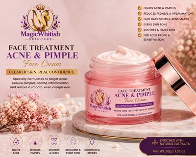 Acne and pimples dark spot face cream