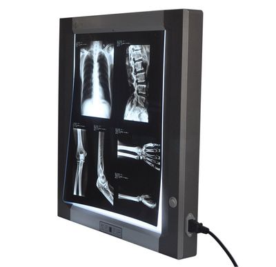 X-Ray Viewer