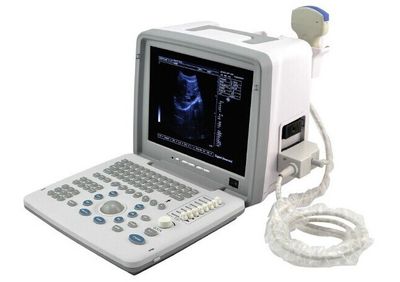 Portable Ultrasound Scanner/Machine+Convex Probe