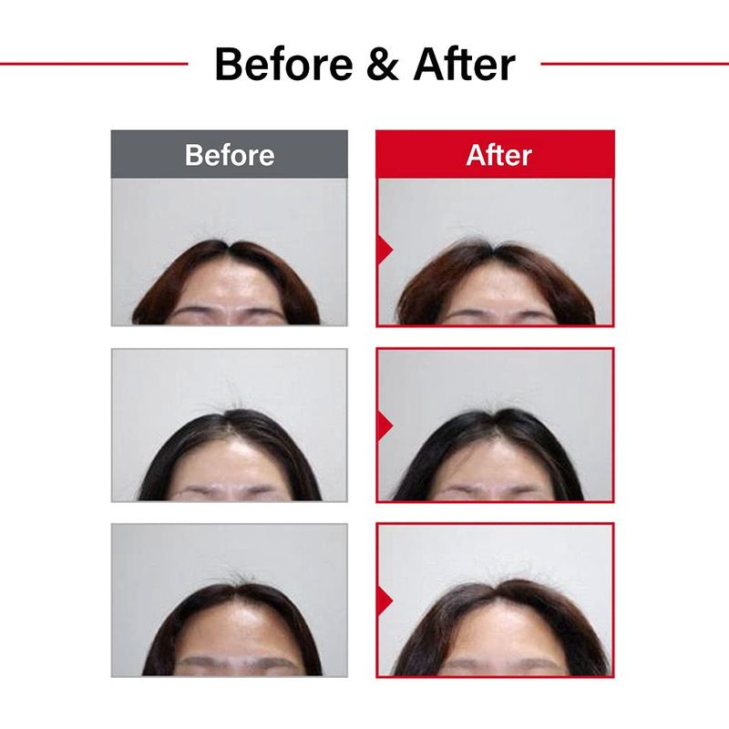 Dr. ForHair Folligen Original Shampoo 500ml