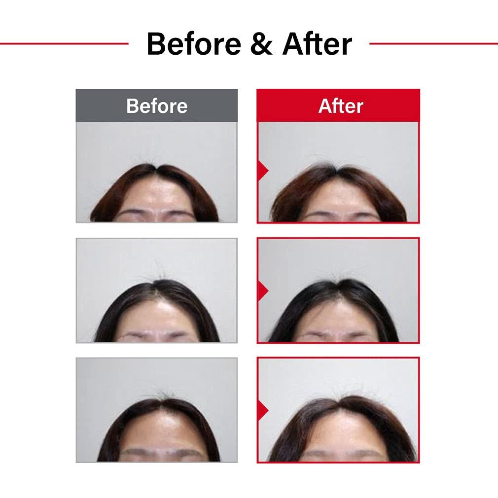 Dr. ForHair Folligen Original Shampoo 500ml