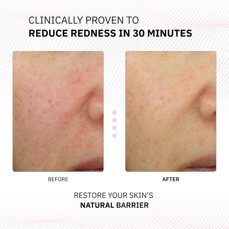 Physiogel Calming Relief Redness Relieving Facial Cream 100ml