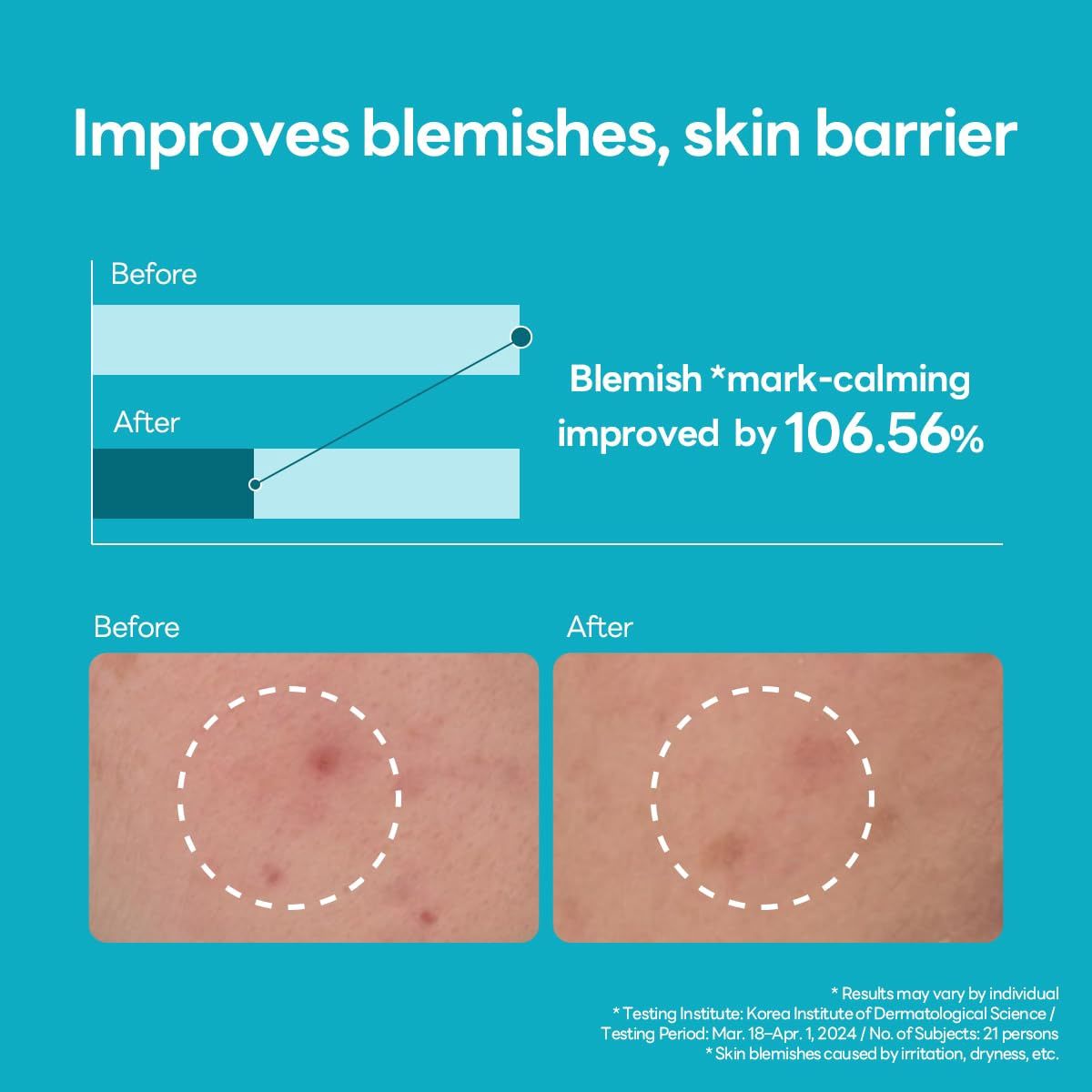 Mediheal Madecassoside Blemish Repair Serum 40 ml