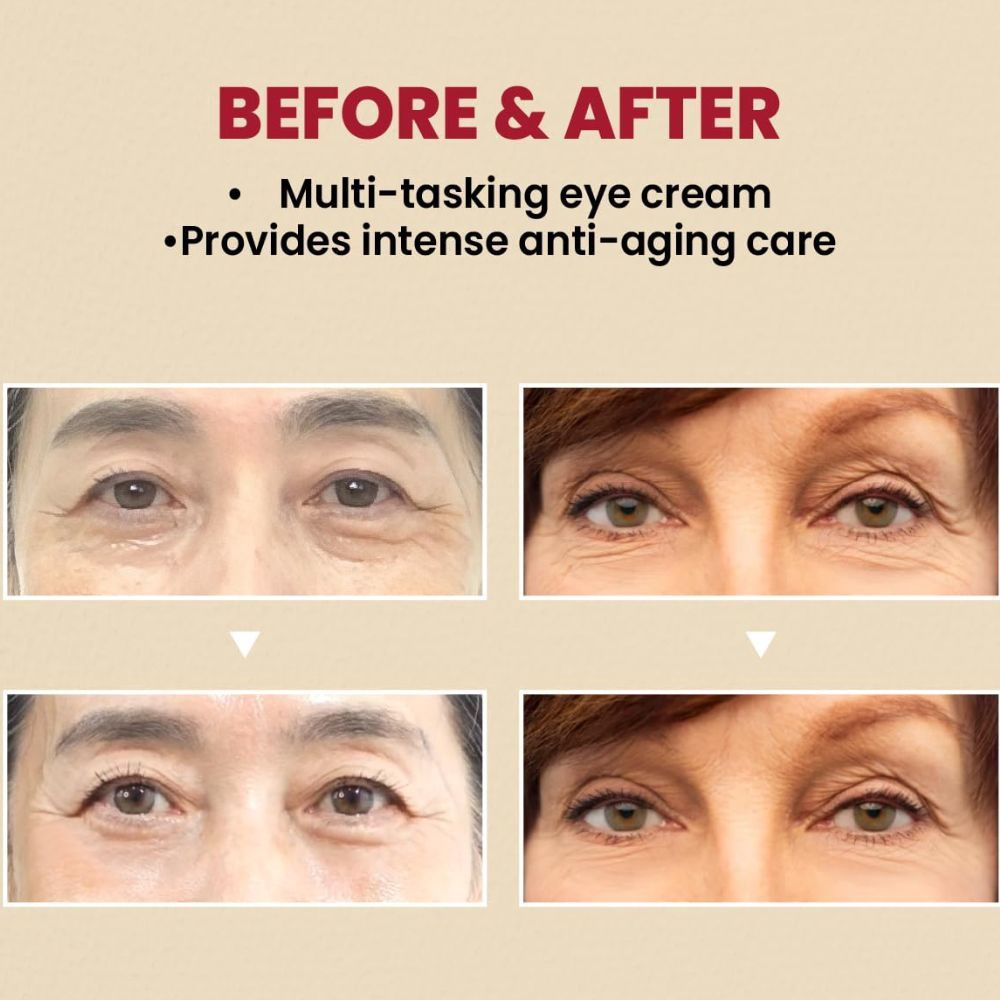 Ksecret Seoul 1988 Eye Cream: Retinal Liposome 4% + Ferment Bean 30ml