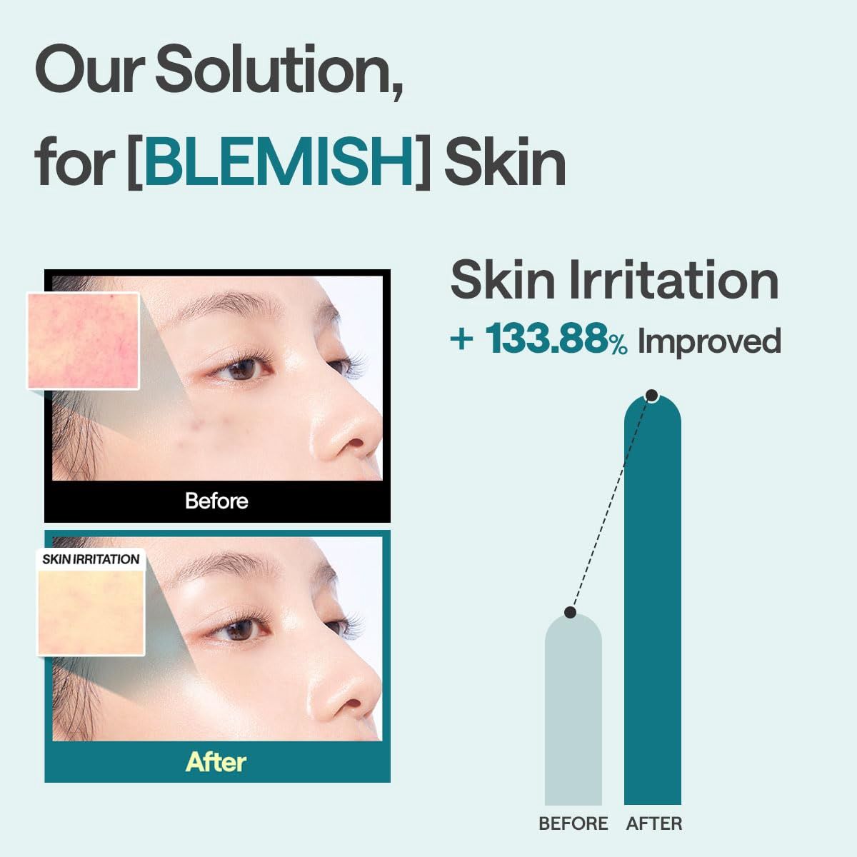Mediheal Madecassoside Essential Mask + Blemish Repair 10pcs/Box
