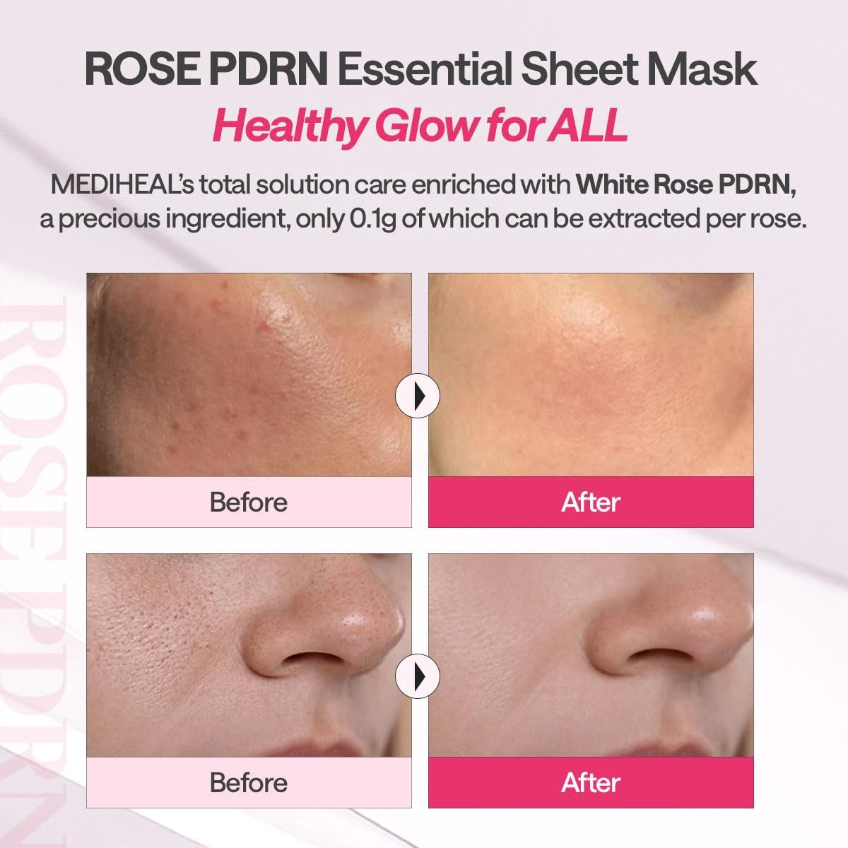 Mediheal Rose PDRN Essential Mask + Healthy Glow 10pcs/Box