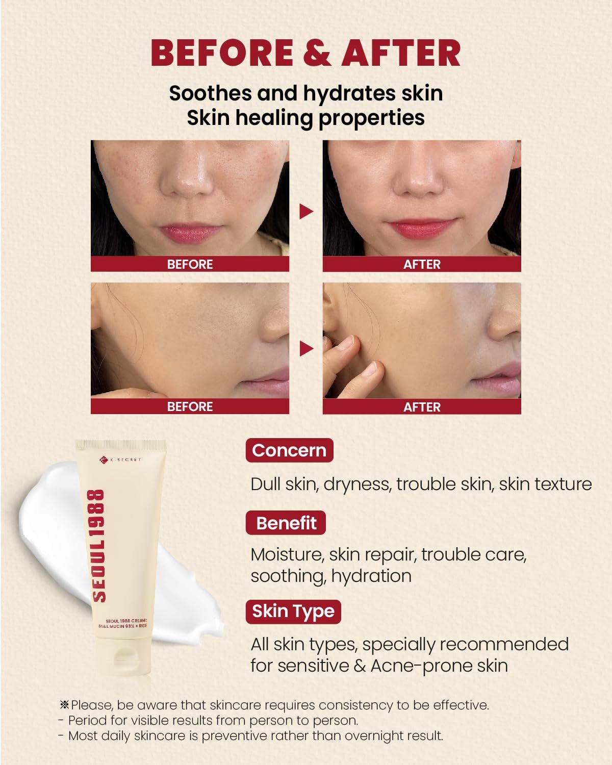 Ksecret Seoul 1988 Cream: Snail Mucin 93% + Rice 100ml