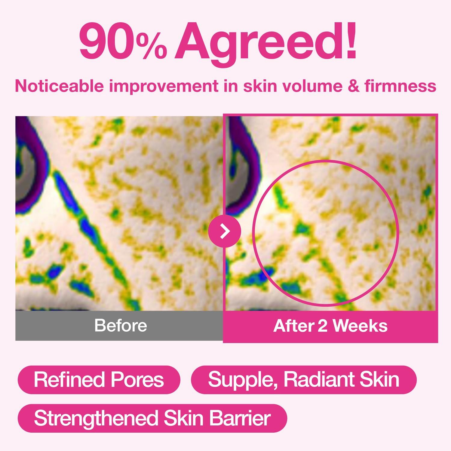 Numbuzin No.2 Rose PDRN Collagen Plumping Sheet Mask 5 Sheets