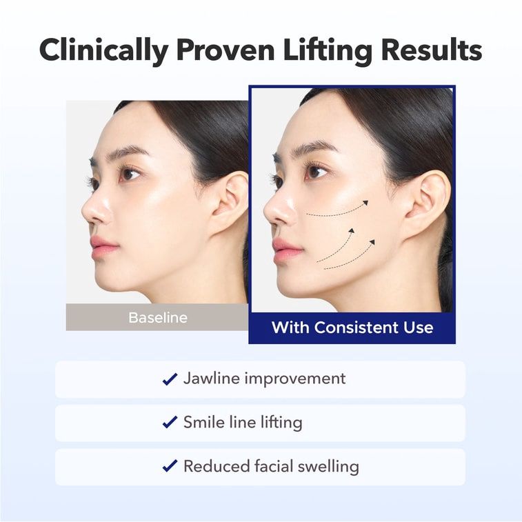 Avajar Rejuvenating Double V Lifting Mask 5 Sheets