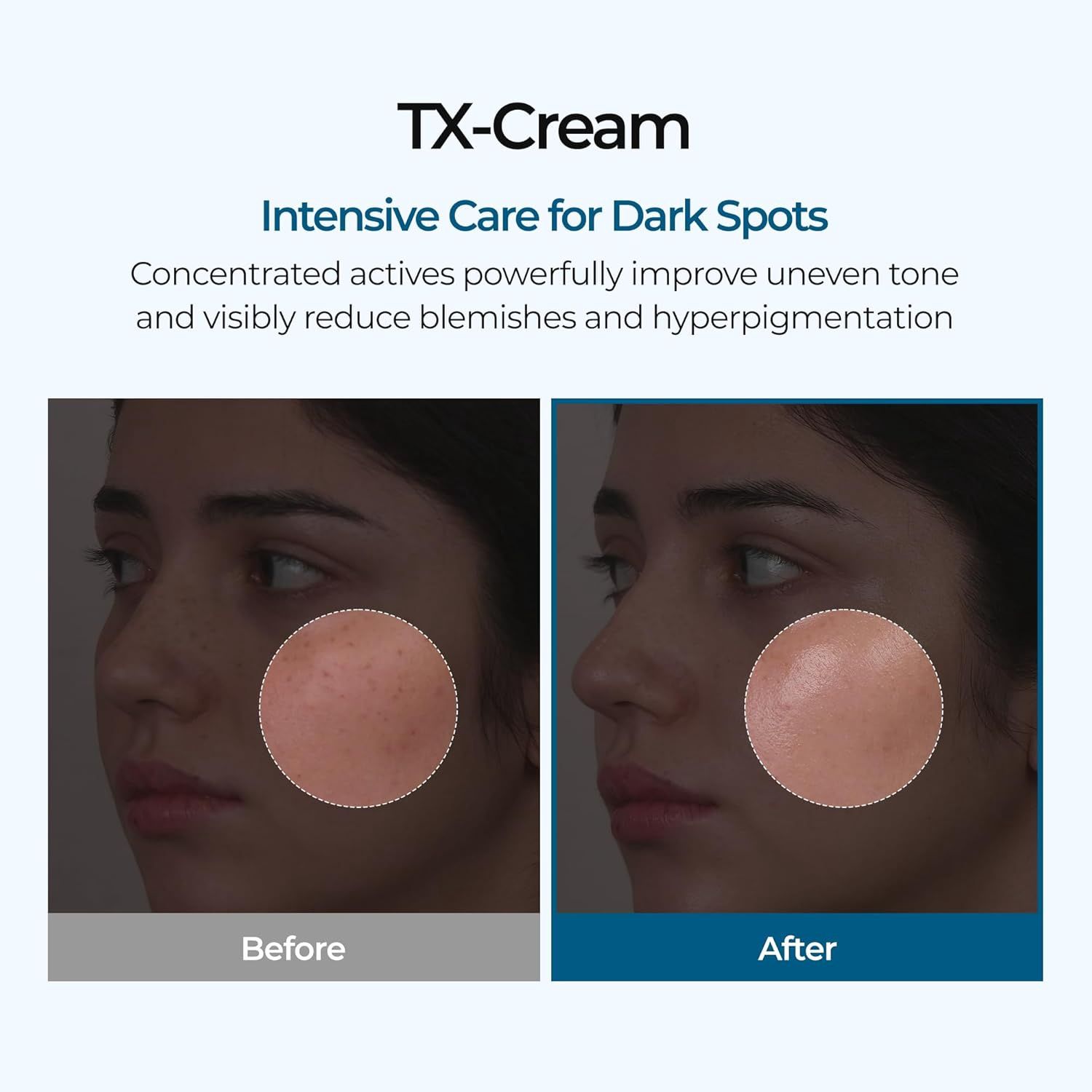 Dr.Melaxin TX Cream 50ml