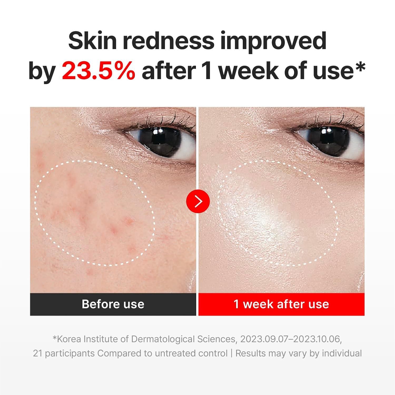Centellian24+ Time Reverse Madeca Cream 50ml