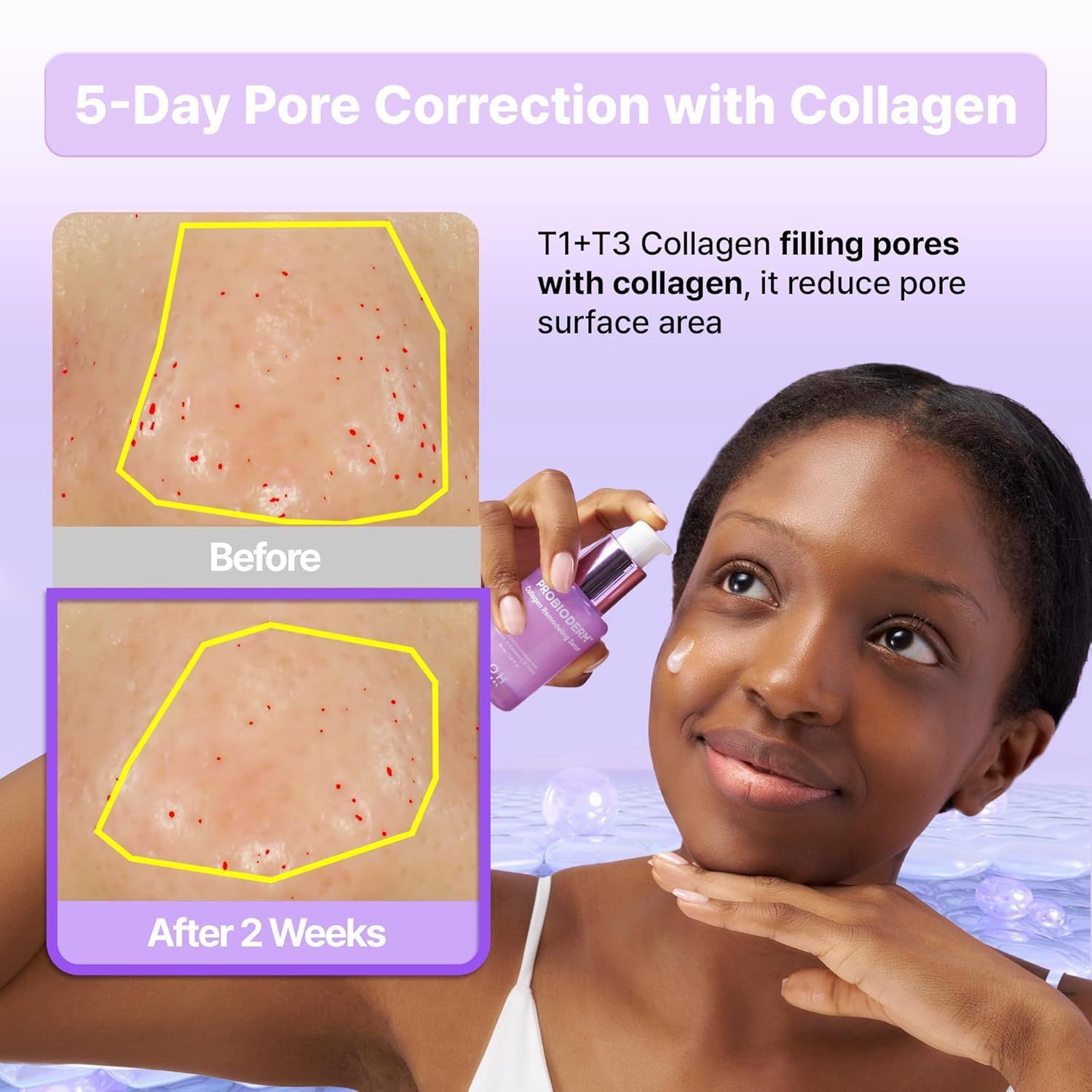 Bioheal BOH Probioderm Collagen Remodeling Serum 30ml