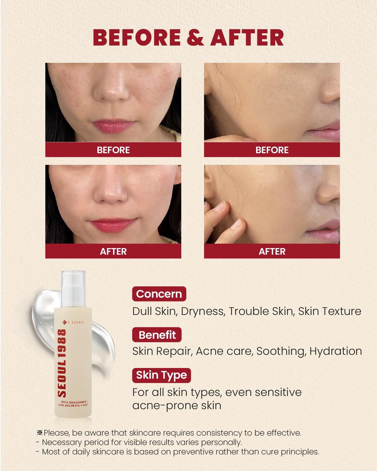 Ksecret Seoul Snail Mucin 97% + Rice Essence 100ml