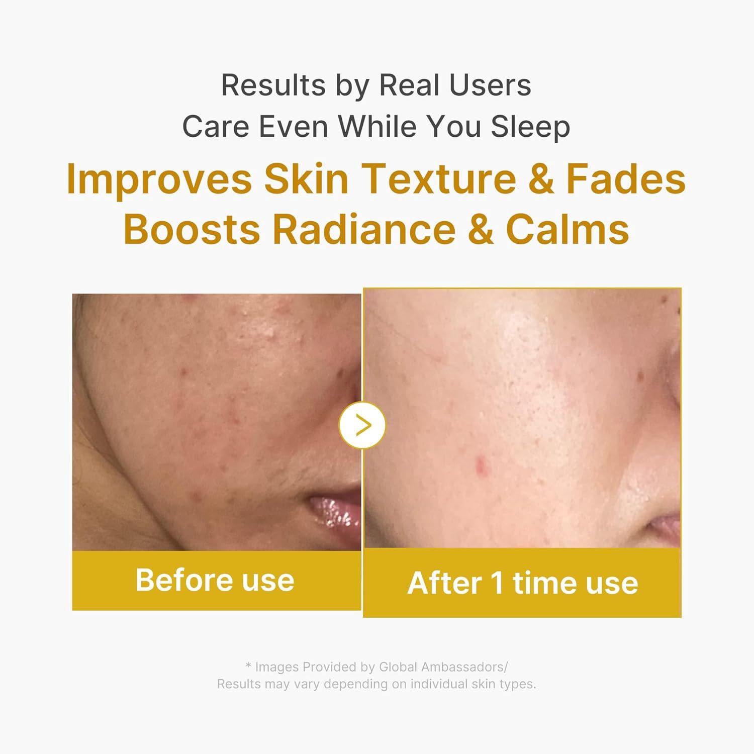 Medicube Kojic Acid Turmeric Night Wrapping Mask 2.0 75ml
