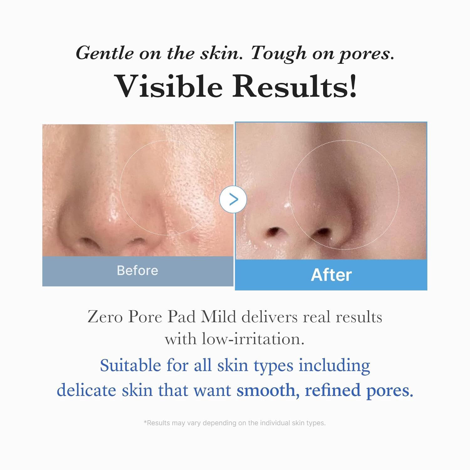 Medicube Zero Pore Pad Mild 70pcs