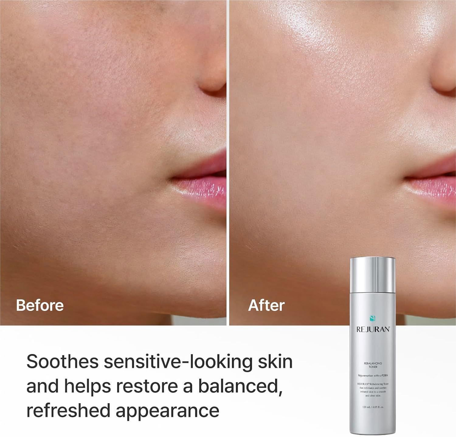 Rejuran Rebalancing Toner 120ml