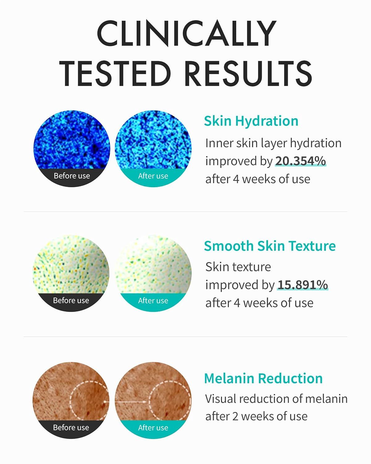 Rejuran Turnover Cream 50ml