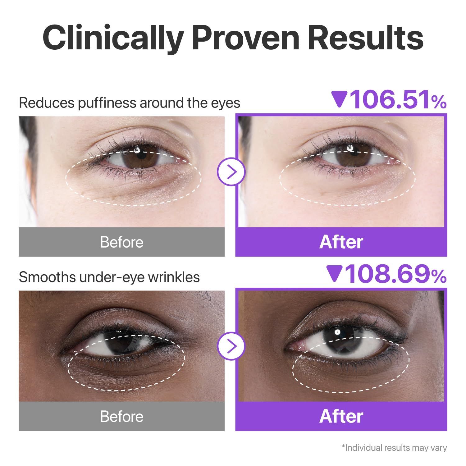 Numbuzin No.9 NAD Collagen Under Eye Patches 5 Pairs