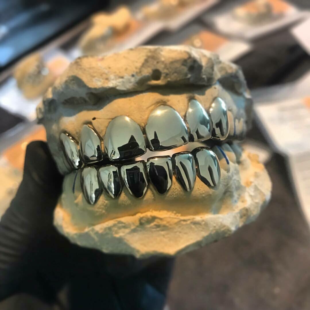 10 Karat Gold Grillz (90 Per Tooth)