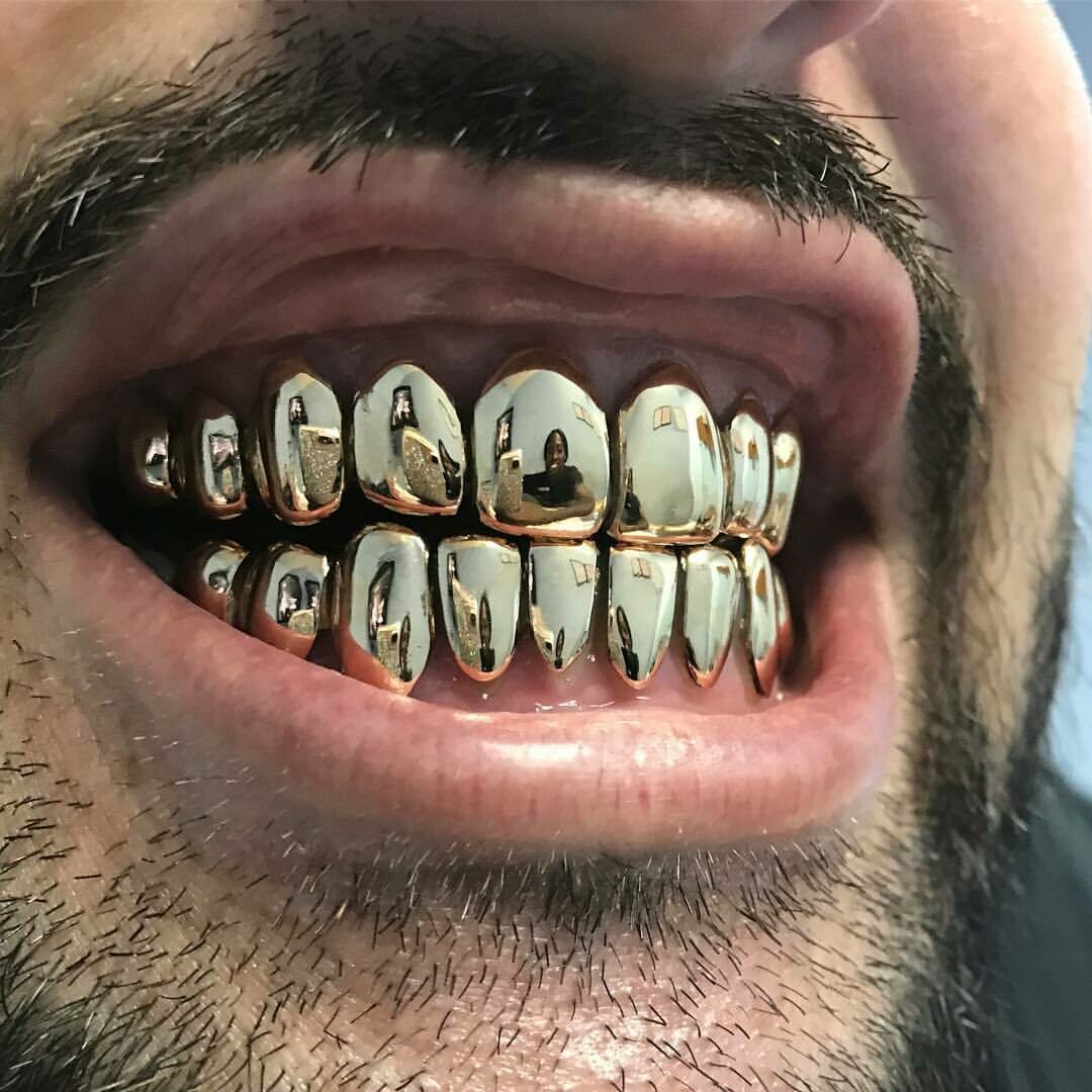 14 Karat Gold Grillz 110 Per Tooth 