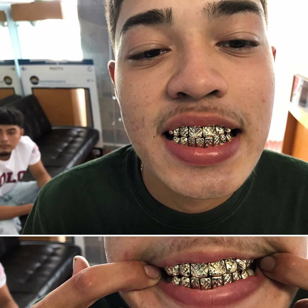 14 Gold Grillz Per Tooth)