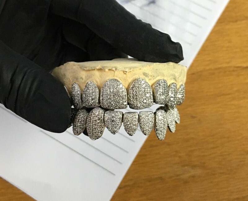 Diamond Grillz (Fully Iced Out)