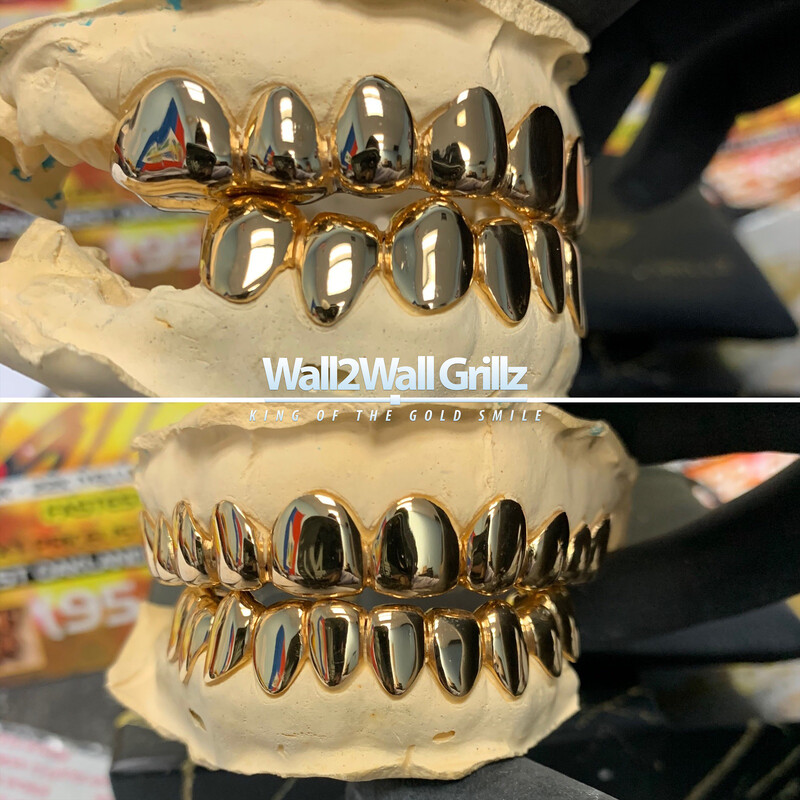 Non-Precious Gold Alloy (NPG) ($35 Per Tooth)