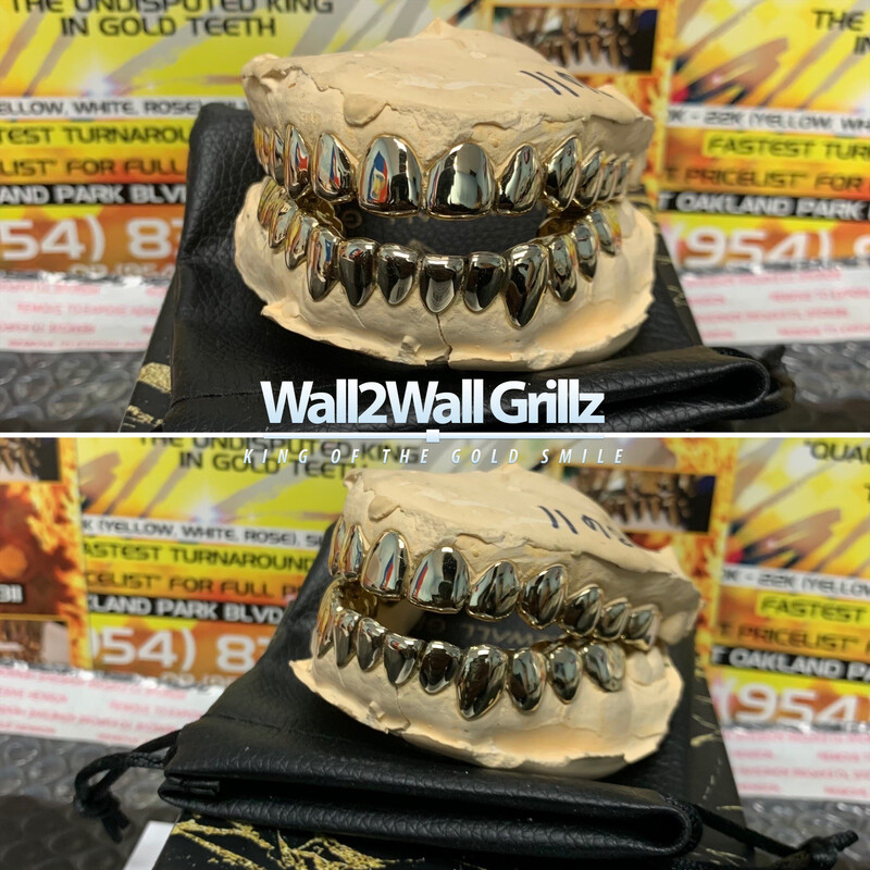 Alternative Gold Alloy (AGA) ($55 Per Tooth)