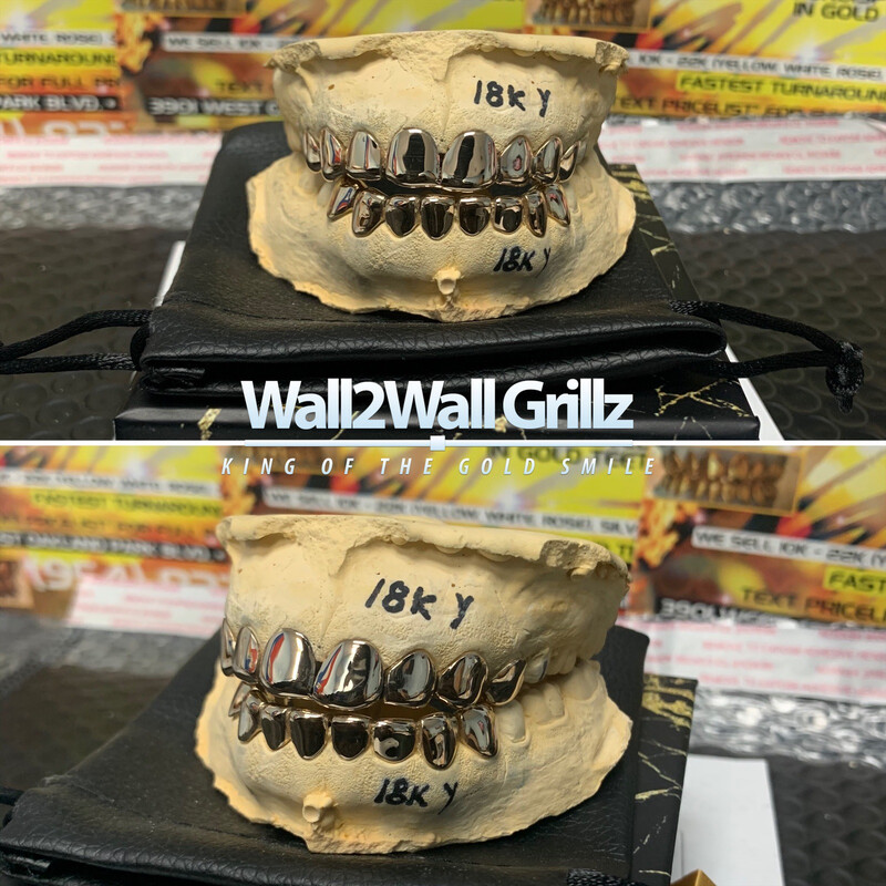 18 Karat Gold Grillz ($370 Per Tooth) 18 Karat Gold Grillz ($370 Per Tooth)