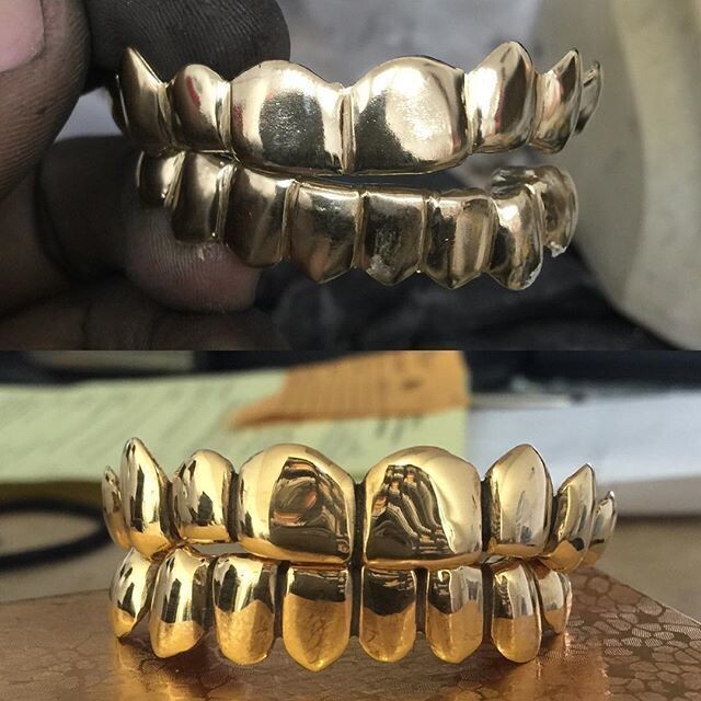 Resurfacing Grillz