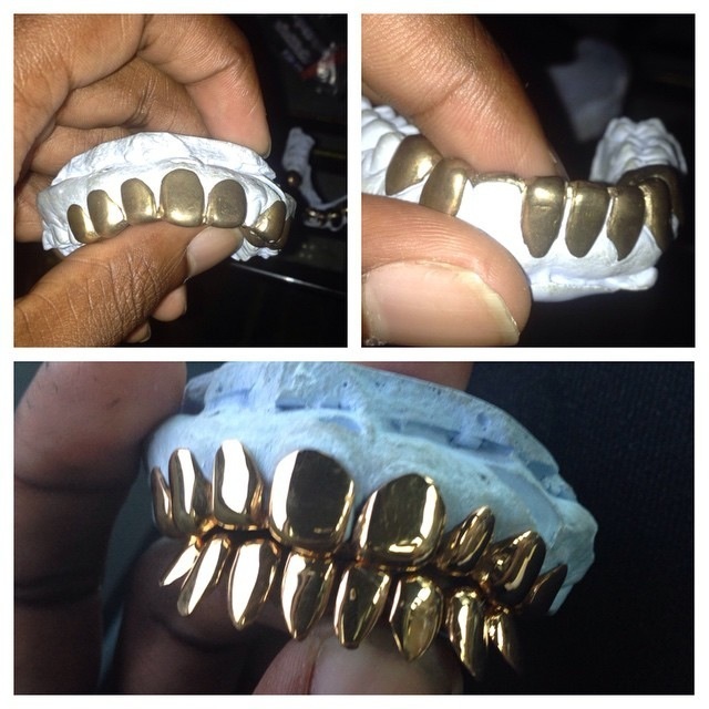 Repair Grillz