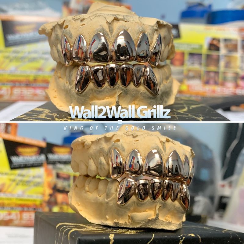10 Karat Gold Grillz ($210 Per Tooth) 10 Karat Gold Grillz ($210 Per Tooth)
