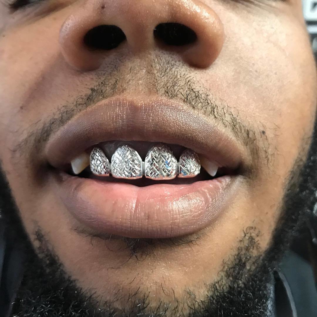 Silver ($25 Per Tooth)