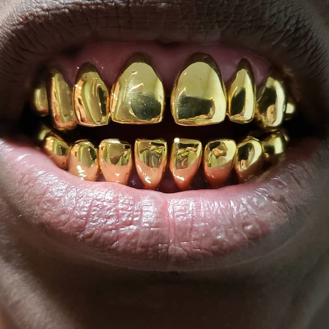 Permanent gold teeth with diamonds best sale