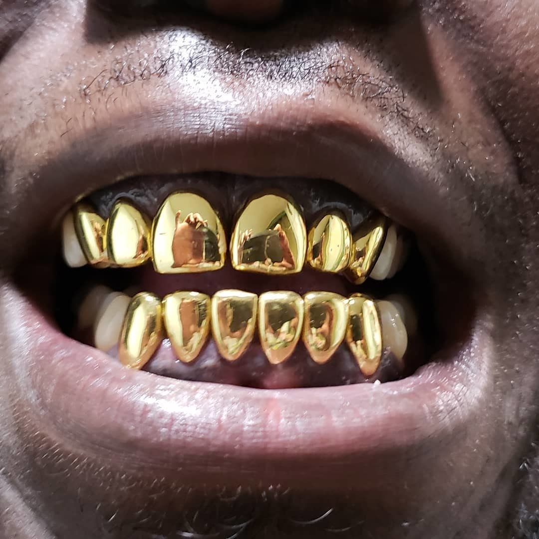Permanent Gold Teeth Designs