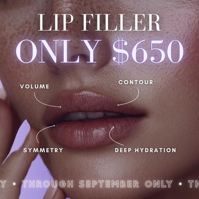 Kysse Lip Filler | $100 OFF Your Syringe