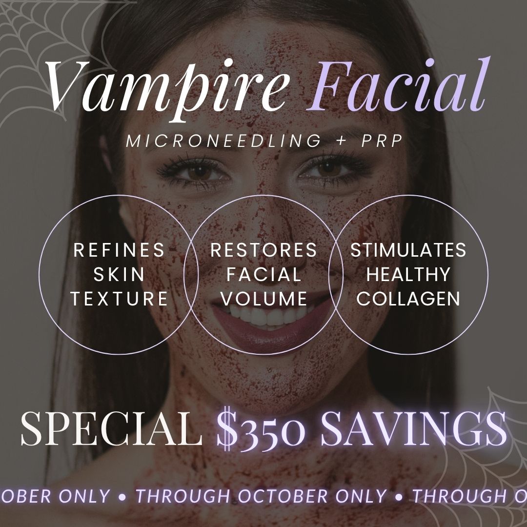 Vampire Facial | ONLY $550