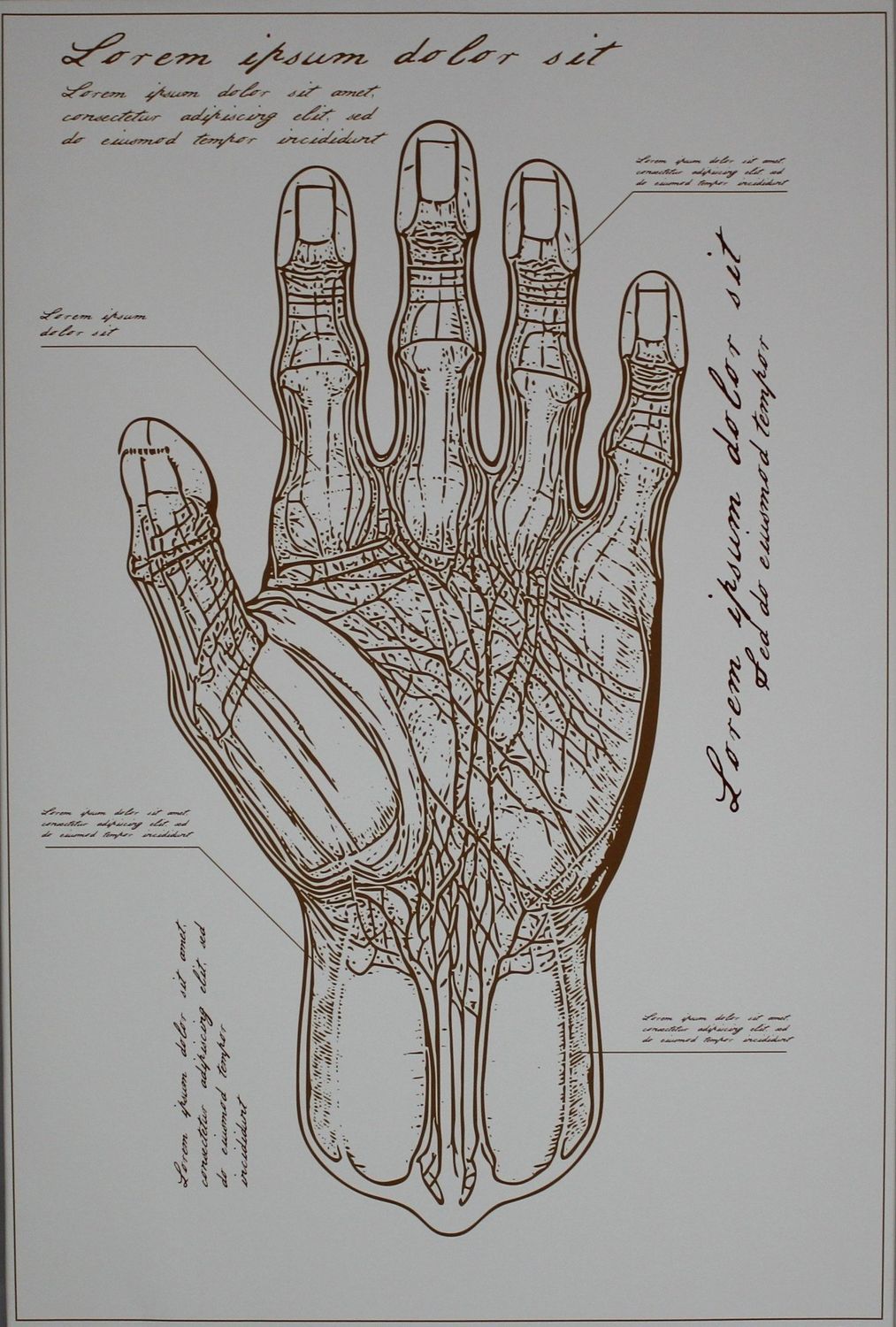 Anatomy III