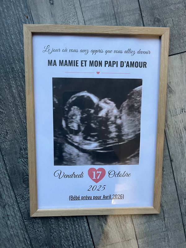 Cadre personnalisé - ECHOGRAPHIE