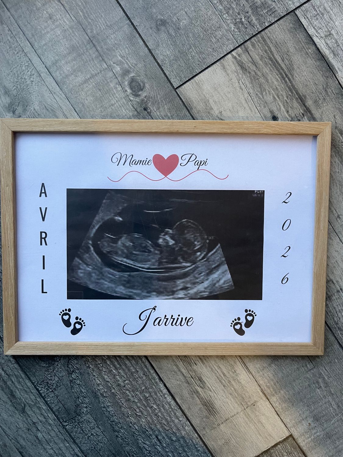 Cadre personnalisé - ECHOGRAPHIE