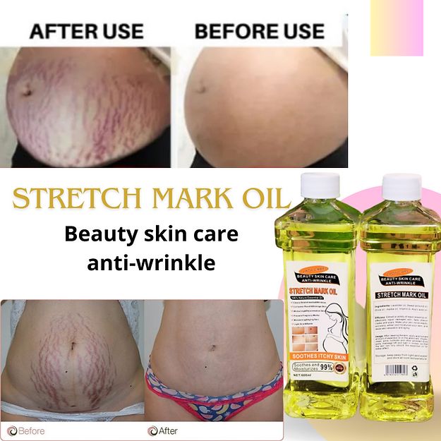 Stretch Mark  remover Oil ANTI-WRINKLE