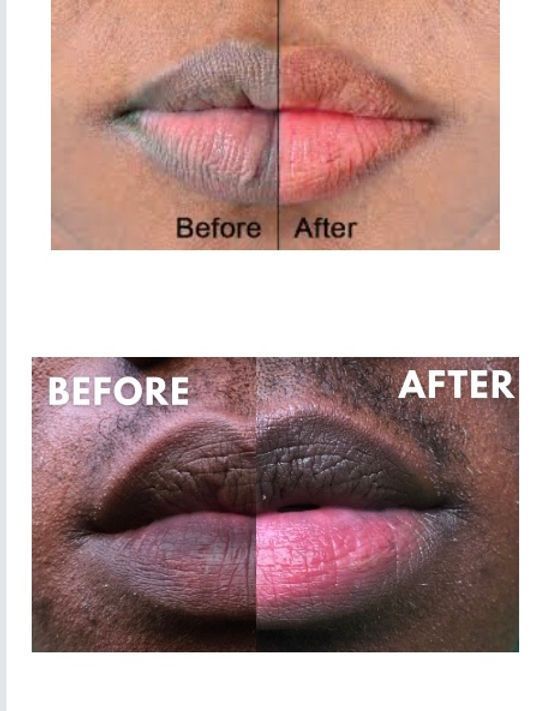 Peach Lip Scrub Fades Lip Lines Hydrates Exfoliates Revitalizes Lip And Tender