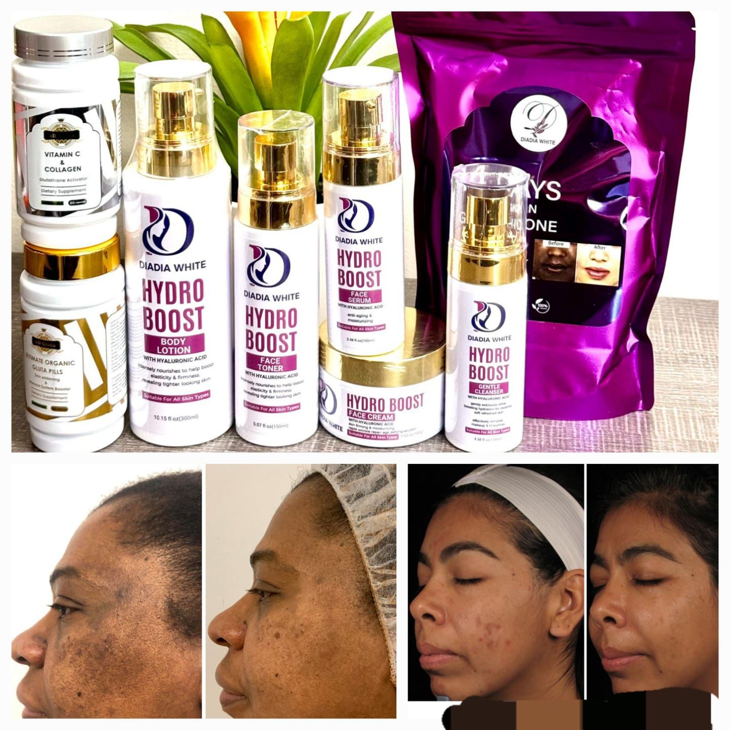 hyaluronic acid skin care products anti aging gluta Tea,gluta pill & collagen