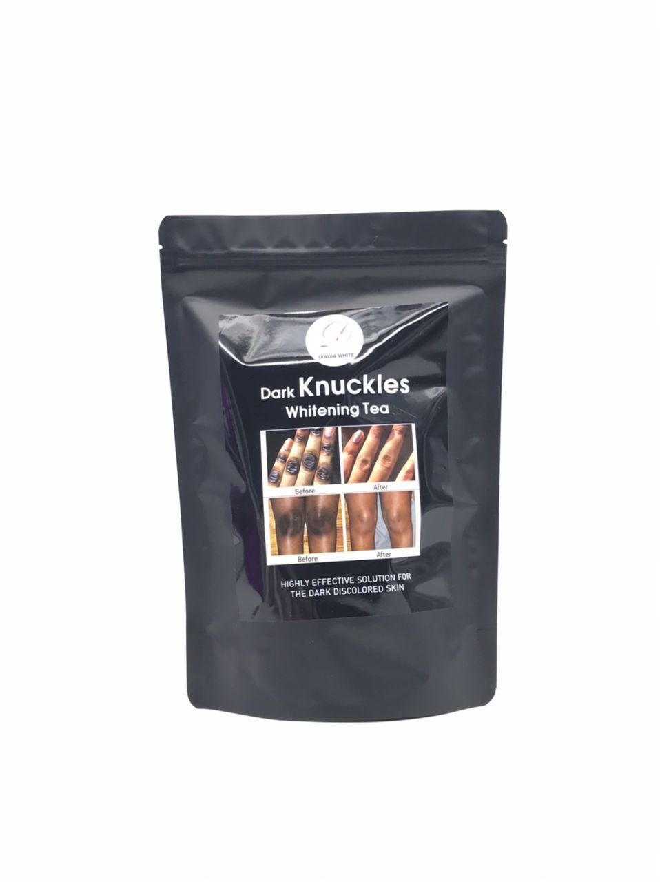 Dark Knuckles, Dark Spot Removal Tea