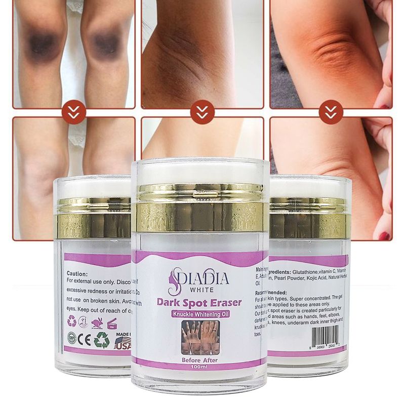 Diadia White Extra Strong Whitening Dark Spot/ Knees/ Elbows Eraser Serum- Fast Action