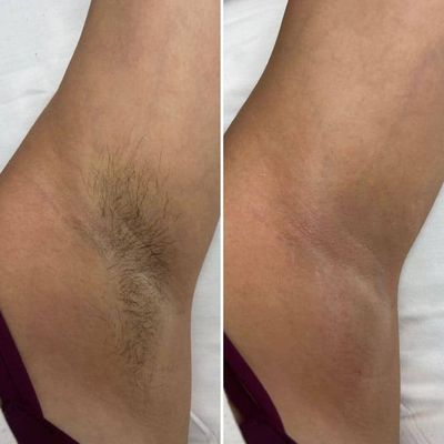 Body Waxing